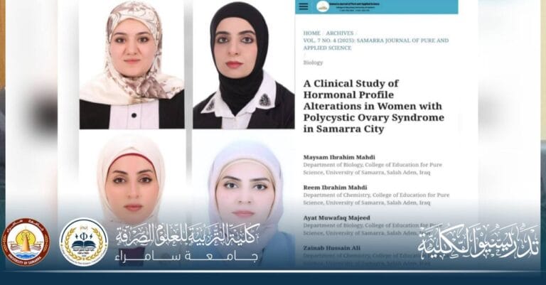 A Research Team at the College of Education for Pure Sciences Publishes a Joint Scientific Study on Polycystic Ovary Syndrome in the City of Samarra